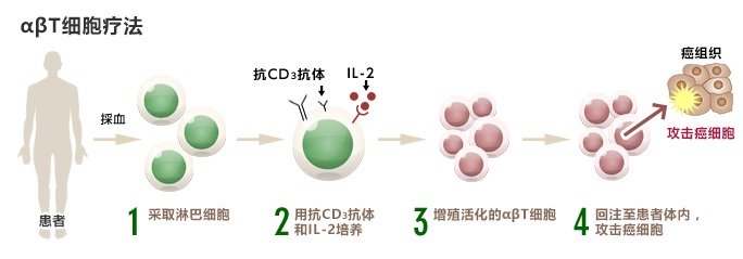 αβT细胞疗法